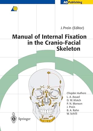 manual of internal fixation in the cranio facial skeleton techniques recommended by the ao/asif maxillofacial