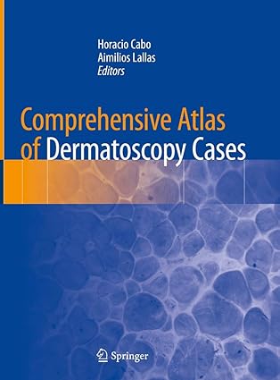 comprehensive atlas of dermatoscopy cases 1st edition horacio cabo ,aimilios lallas 3319769316, 978-3319769318
