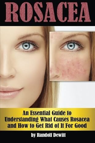 rosacea an essential guide to understanding what causes rosacea and how to get rid of it for good 1st edition