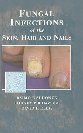 fungal infections of the skin and nails 1st edition raimo e suhonen ,rodney p r dawber ,david h ellis