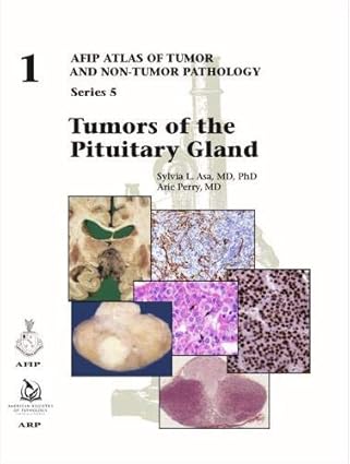 tumors of the pituitary gland 1st edition sylvia l asa 1933477911, 978-1933477916