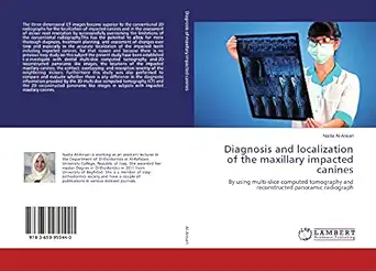 diagnosis and localization of the maxillary impacted canines by using multi slice computed tomography and