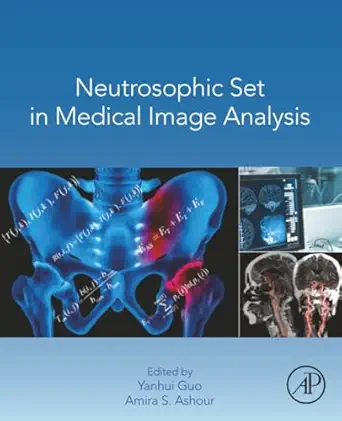 neutrosophic set in medical image analysis 1st edition yanhui guo ,amira s ashour 0128181486, 978-0128181485