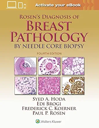 rosens diagnosis of breast pathology by needle core biopsy 1st edition syed a hoda md ,paul peter rosen md
