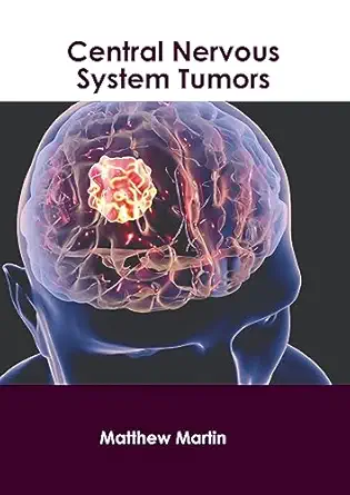 central nervous system tumors 1st edition matthew martin 1639279725, 978-1639279722