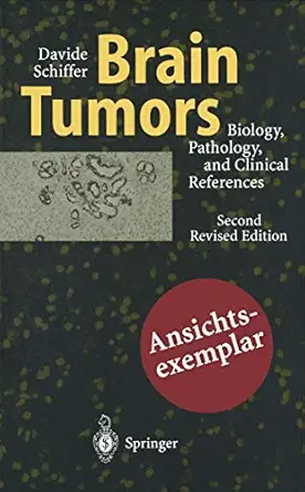 brain tumors biology pathology and clinical references 1st edition davide schiffer ,m t giordana ,a mauro ,r