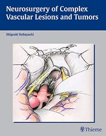neurosurgery of complex vascular lesions and tumors 1st edition s kobayashi 1588902242, 978-1588902245