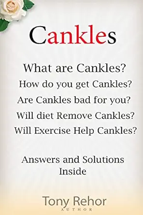 cankles this guide will answer all of your cankles questions 1st edition tony rehor 1482785811, 978-1482785814