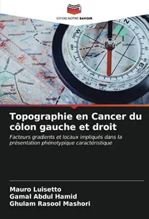 topographie en cancer du ca lon gauche et droit facteurs gradients et locaux impliquas dans la prasentation