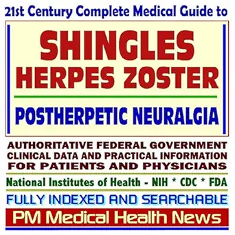 21st century complete medical guide to shingles herpes zoster postherpetic neuralgia authoritative government