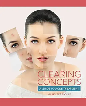clearing concepts a guide to acne treatment 1st edition mark lees 1133280315, 978-1133280316