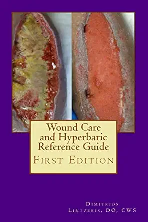 wound care and hyperbaric reference guide 1st edition dimitrios p lintzeris do 1530982472, 978-1530982479