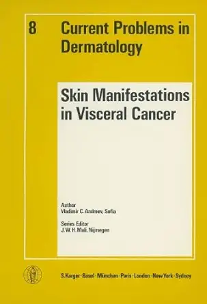 skin manifestations in visceral cancer 1st edition v c andreev 3805528787, 978-3805528788