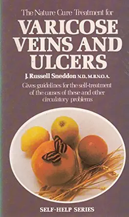 nature cure treatment for varicose veins and ulcers 1st edition j russell sneddon 0722502699, 978-0722502693