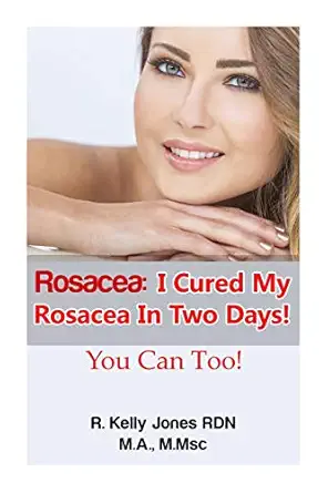 rosacea i cured my rosacea in two days you can too 1st edition r kelly jones ,cavenaugh kelly 150846328x,