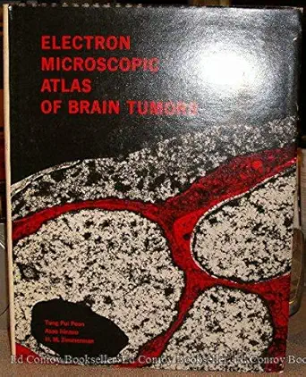 electron microscopic atlas of brain tumors 1st edition tung p poon 0808907409, 978-0808907404