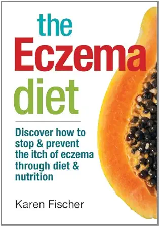 the eczema diet discover how to stop and prevent the itch of eczema through diet and nutrition 1st edition