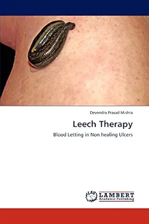 leech therapy blood letting in non healing ulcers 1st edition devendra prasad mishra 365929425x,