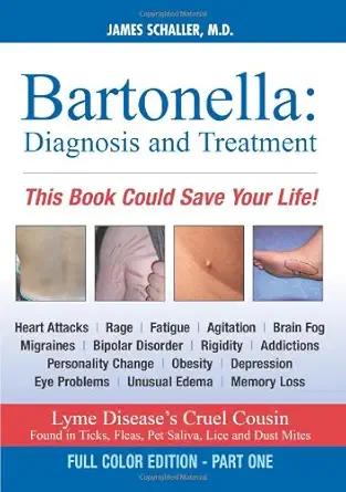 bartonella diagnosis and treatment part 1 of 2 full 1st edition james l schaller md 0979925088, 978-0979925085