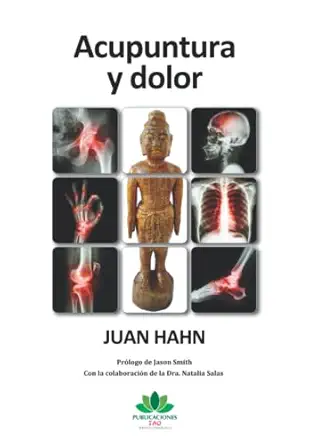 acupuntura y dolor 1st edition juan hahn 8419470937, 978-8419470935