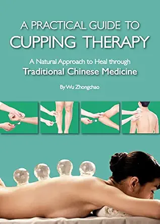 practical guide to cupping therapy a natural approach to heal through traditional chinese medicine 1st