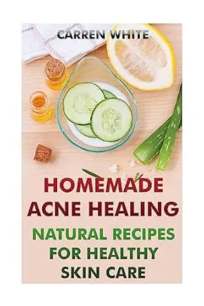 homemade acne healing natural recipes for healthy skin care 1st edition carren white 1542886732,