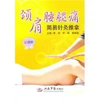 neck shoulder low back pain acupuncture simple 1st edition li jun i 1/4 qiao feng i 1/4 ge ji kui 7509145457,