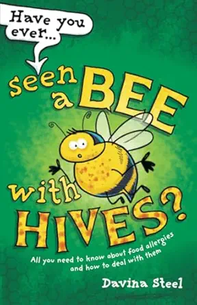 have you ever seen a bee with hives all you need to know about food allergies and how to deal with them 1st
