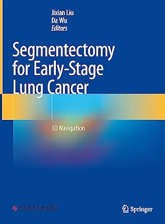 segmentectomy for early stage lung cancer 3d navigation 1st edition jixian liu ,da wu 9819901421,