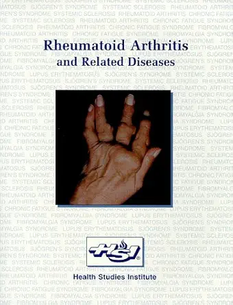 rheumatoid arthritis and related diseases 1st edition robert p sundel 1879772108, 978-1879772106