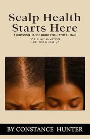 scalp health starts here from root to tip a growing hands guide for natural hair 1st edition constance m