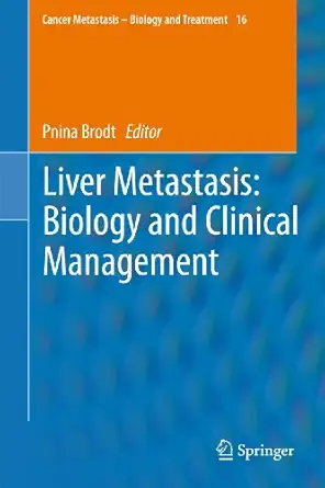 liver metastasis biology and clinical management 1st edition pnina brodt 9400735456, 978-9400735453