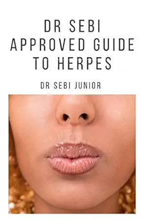 dr sebi approved guide to herpes includes natural remedy how to manage and everything you need to know about