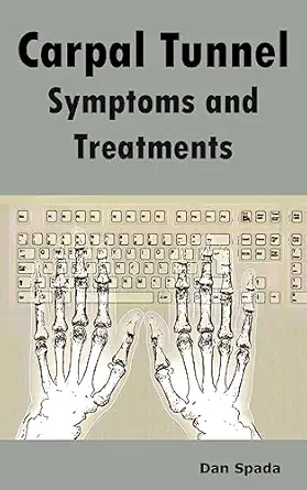 carpal tunnel symptoms and treatments all about carpal tunnel syndrome causes diagnosing symptoms signs non