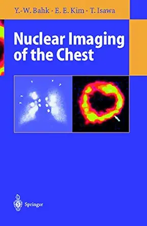 nuclear imaging of the chest 1st edition yong whee bahk ,e edmund kim ,toyoharu isawa 364280389x,