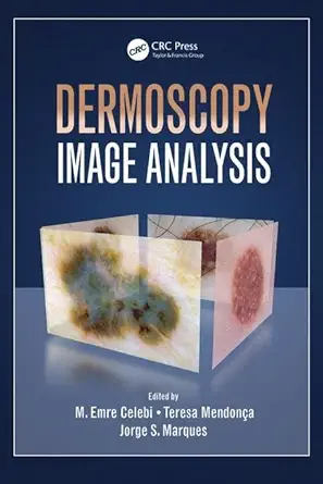 dermoscopy image analysis 1st edition m emre celebi ,teresa mendonca ,jorge s marques 1482253267,