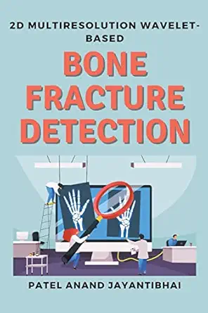 2d multiresolution wavelet based bone fracture detection 1st edition patel anand jayantibhai 5673829264,