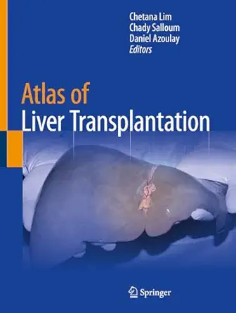 atlas of liver transplantation 1st edition chetana lim ,chady salloum ,daniel azoulay 303185263x,
