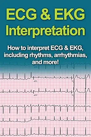 ecg and ekg interpretation how to interpret ecg and ekg including rhythms arrhythmias and more 1st edition