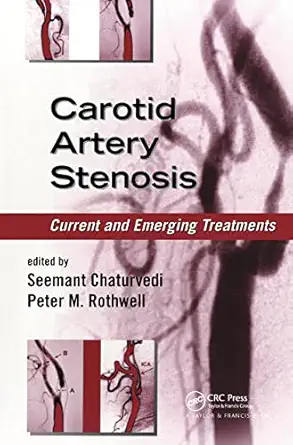 carotid artery stenosis current and emerging treatments 1st edition seemant chaturvedi ,peter m rothwell