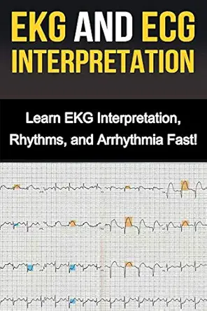 ekg and ecg interpretation learn ekg interpretation rhythms and arrhythmia fast 1st edition alyssa stone