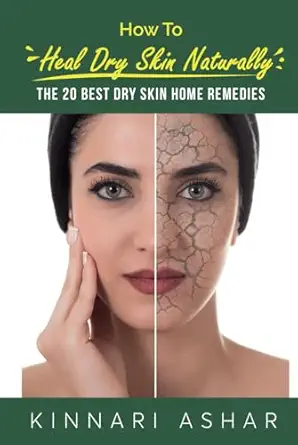 how to heal dry skin naturally the 20 best dry skin home remedies 1st edition kinnari ashar ,neil germio