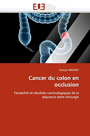 cancer du colon en occlusion faisabilita et rasultats carcinologiques de la saquence stent chirurgie 1st