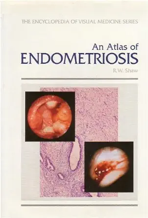 an atlas of endometriosis 1st edition r w shaw 1850703906, 978-1850703907