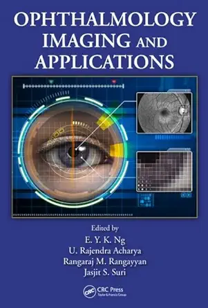 ophthalmological imaging and applications 1st edition e y k ng ,u rajendra acharya ,rangaraj m rangayyan