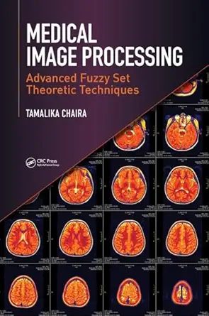 medical image processing advanced fuzzy set theoretic techniques 1st edition tamalika chaira 1498700454,