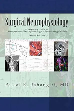 surgical neurophysiology a reference guide to intraoperative neurophysiological monitoring 1st edition faisal
