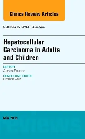 hepatocellular carcinoma in adults and children an issue of clinics in liver disease 1st edition adrian