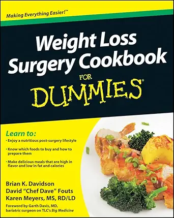 weight loss surgery cookbook for dummies 1st edition brian k davidson ,david fouts ,karen meyers 0470640189,