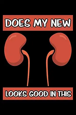 does my new kidney looks good in this organ donation awareness notebook to write in 6x9 lined 120 pages